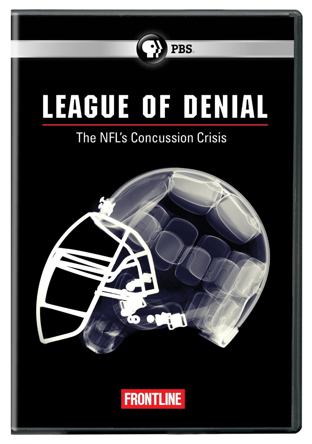 League of Denial: The NFL's Concussion Crisis League of Denial: The NFL's Concussion Crisis